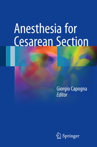 Abbildung von: Anesthesia for Cesarean Section - Springer