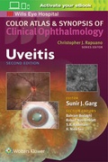 Cover: Uveitis - Lippincott Williams and Wilkins