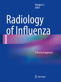 Abbildung von: Radiology of Influenza - Springer