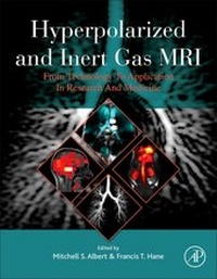 Abbildung von: Hyperpolarized and Inert Gas MRI - Academic Press