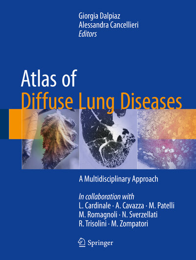 Abbildung von: Atlas of Diffuse Lung Diseases - Springer