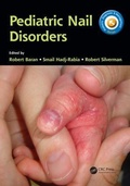 Cover: Pediatric Nail Disorders - CRC Press