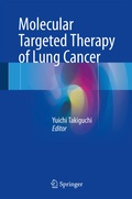 Bild: Molecular Targeted Therapy of Lung Cancer - Springer