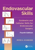 Bild: Endovascular Skills - CRC Press