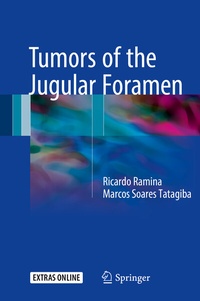 Abbildung von: Tumors of the Jugular Foramen - Springer
