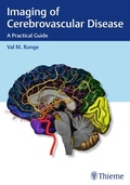 Cover: Imaging of Cerebrovascular Disease - Thieme Publishers