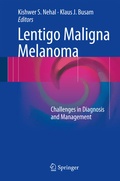 Cover: Lentigo Maligna Melanoma - Springer