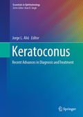 Cover: Keratoconus - Springer