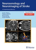 Cover: Neurosonology and Neuroimaging of Stroke - Thieme