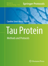 Abbildung von: Tau Protein - Humana