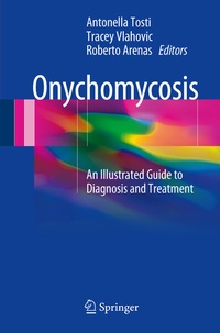 Abbildung von: Onychomycosis - Springer