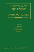 Bild: How to face 'the faces' of CARDIAC PACING - Springer