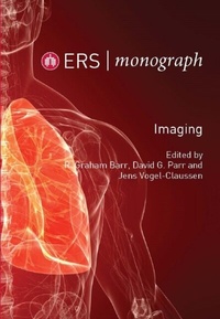 Abbildung von: Imaging - European Respiratory Society