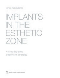 Abbildung von: Implants in the Esthetic Zone - Quintessenz Verlags GmbH