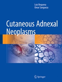 Abbildung von: Cutaneous Adnexal Neoplasms - Springer