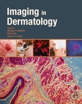Cover: Imaging in Dermatology - Academic Press