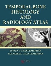 Abbildung von: Temporal Bone Histology and Radiology Atlas - Plural Publishing Inc
