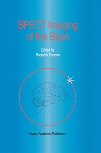 Abbildung von: SPECT Imaging of the Brain - Springer
