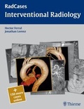 Cover: Radcases Interventional Radiology - Thieme Publishers