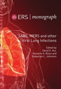 Abbildung von: SARS, MERS and other Viral Lung Infections - European Respiratory Society