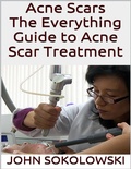 Cover: Acne Scars: The Everything Guide to Acne Scar Treatment - Lulu.com