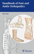 Cover: Handbook of Foot and Ankle Orthopedics - Thieme Publishers