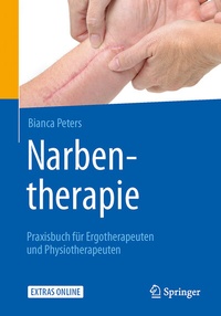 Abbildung von: Narbentherapie - Springer