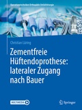 Cover: Zementfreie H&uuml;ftendoprothese: lateraler Zugang nach Bauer - Springer