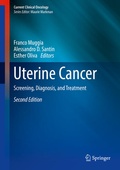 Cover: Uterine Cancer - Springer