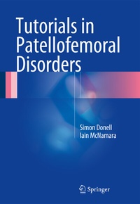 Abbildung von: Tutorials in Patellofemoral Disorders - Springer