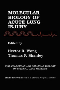 Abbildung von: Molecular Biology of Acute Lung Injury - Kluwer Academic Publishers
