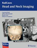 Cover: RadCases Head and Neck Imaging - Thieme Publishers