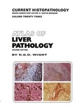 Cover: Atlas of Liver Pathology - Kluwer Academic Publishers