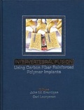 Cover: Intervertebral Fusion Using Carbon Fiber Reinforced Polymer Implants - Thieme Publishers