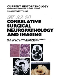 Abbildung von: Atlas of Correlative Surgical Neuropathology and Imaging - Kluwer Academic Publishers
