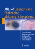 Cover: Atlas of Diagnostically Challenging Melanocytic Neoplasms - Springer