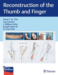 Enlarge image Cover: Reconstruction of the Thumb and Finger - Thieme Publishers