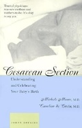 Cover: Cesarean Section - Johns Hopkins University Press