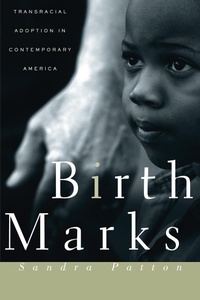 Abbildung von: Birthmarks - New York University Press