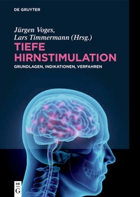 Abbildung von: Tiefe Hirnstimulation - De Gruyter