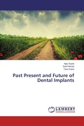 Cover: Past Present and Future of Dental Implants - LAP Lambert Academic Publishing