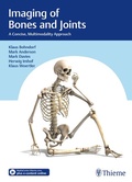 Cover: Imaging of Bones and Joints - Thieme