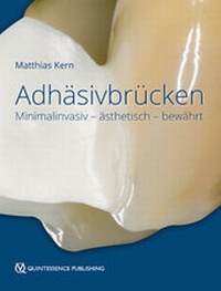 Abbildung von: Adhäsivbrücken - Quintessenz Verlag