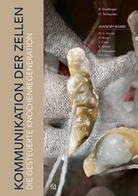 Abbildung von: Die gesteuerte Knochenregeneration - Quintessenz Verlag