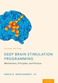 Abbildung von: Deep Brain Stimulation Programming - OUP eBook