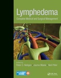 Cover: Lymphedema - Thieme Publishers