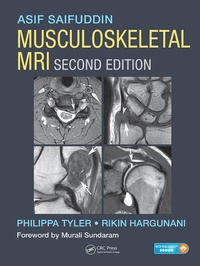 Abbildung von: Musculoskeletal MRI - CRC Press