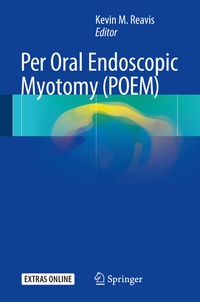 Abbildung von: Per Oral Endoscopic Myotomy (POEM) - Springer