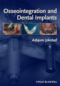 Abbildung von: Osseointegration and Dental Implants - Wiley-Blackwell