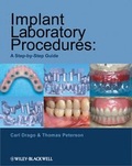 Cover: Implant Laboratory Procedures - Iowa State University Press